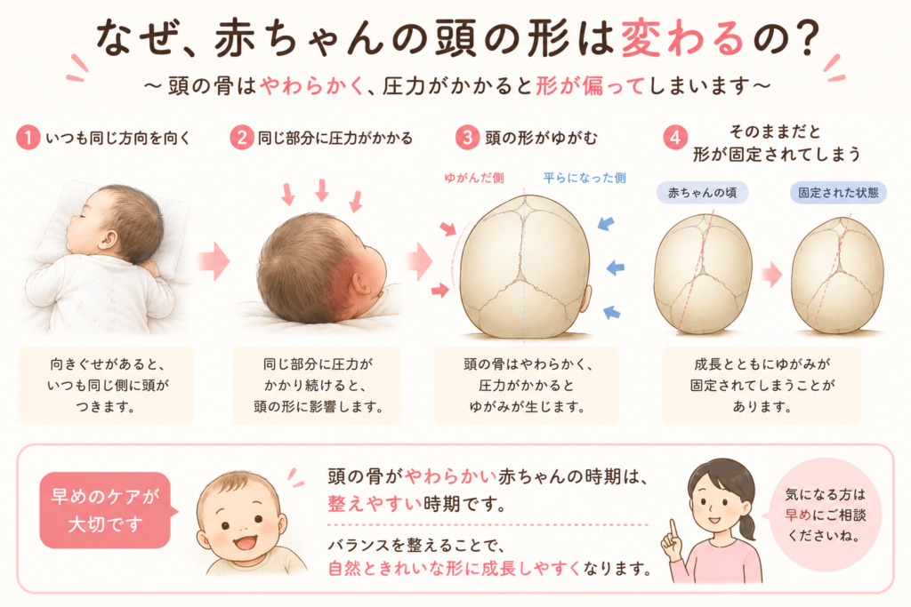 向き癖から頭の形が変化していく流れを説明したイラスト